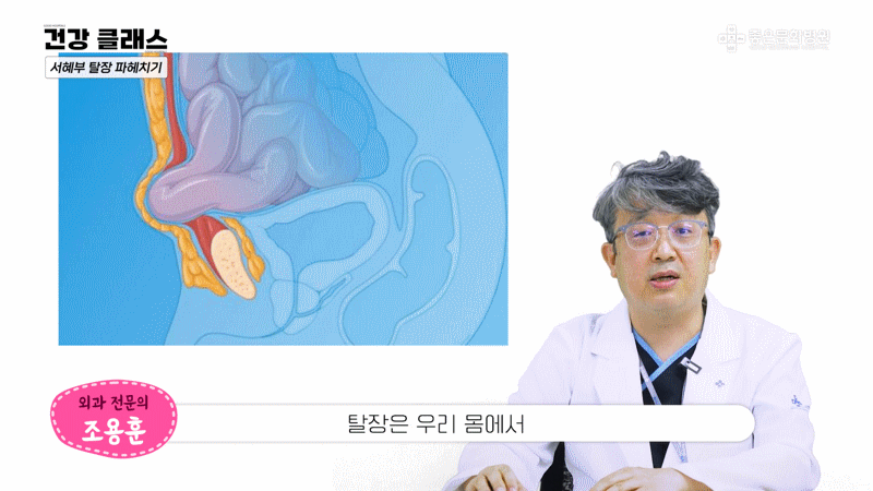 서혜부 탈장 위치