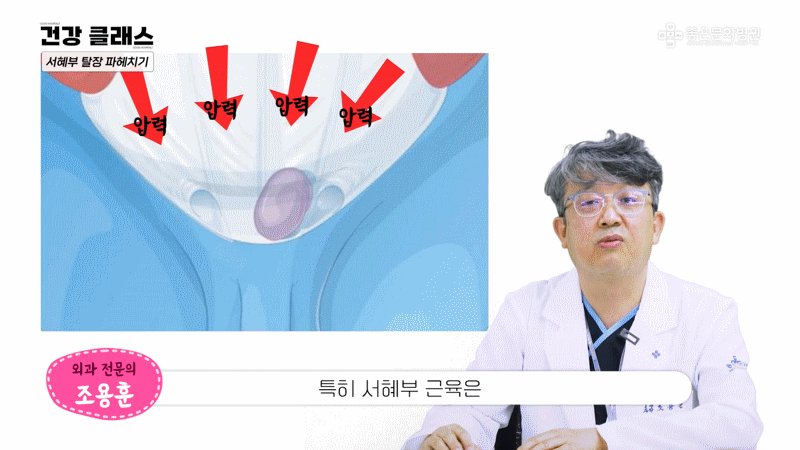 탈장 원인 : 복벽 약화
