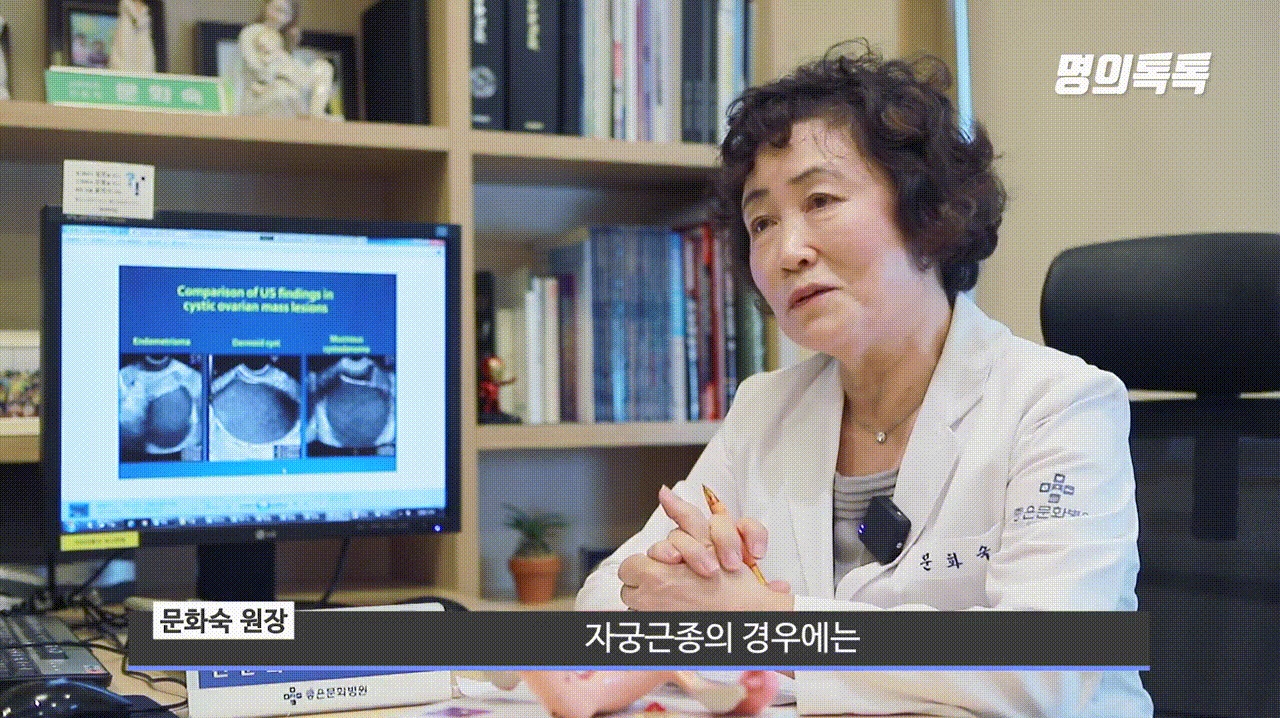 자궁근종 진단 시 MRI 검사가 필요한 이유