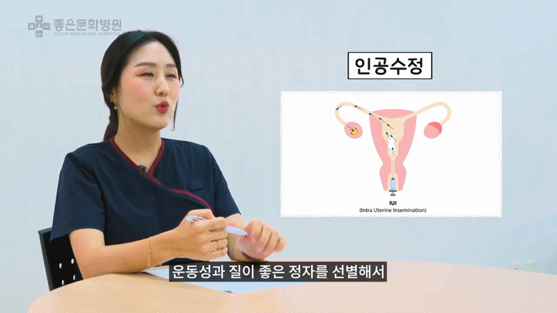 인공수정 시술 방법