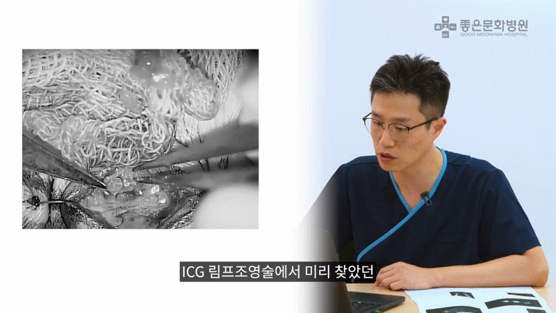림프관정맥문합술 진행 모습